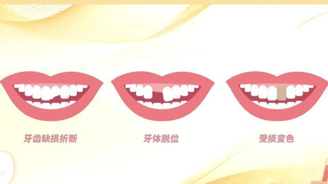 是爱美！有些人一定要做m6米乐牙齿正畸不只(图4)
