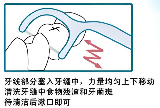 的卫生习惯--小鹿妈妈牙线米乐m6登录入口年夜饭后